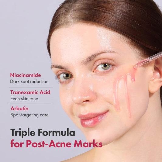 Niacinamide 10% + TXA Brightening Face Serum 33ml