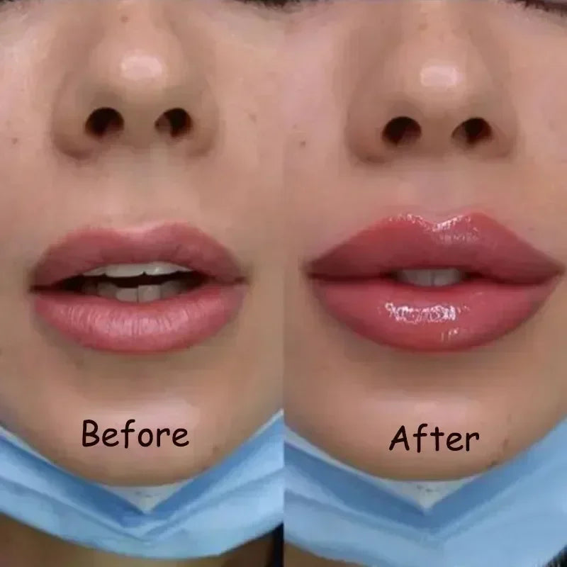 Instant Lip Plumper Oil – Hydrating Volumizing Gloss Serum 💋